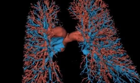 Addressing inequalities in healthcare