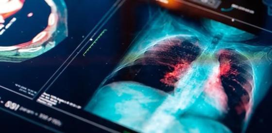 Venturing forth Cambridge Judge Business School